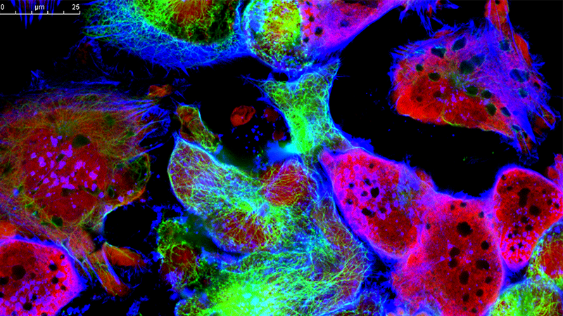 Xenograft and Live Imaging